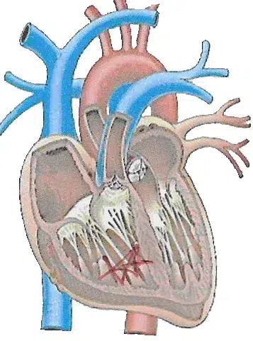 le coeur